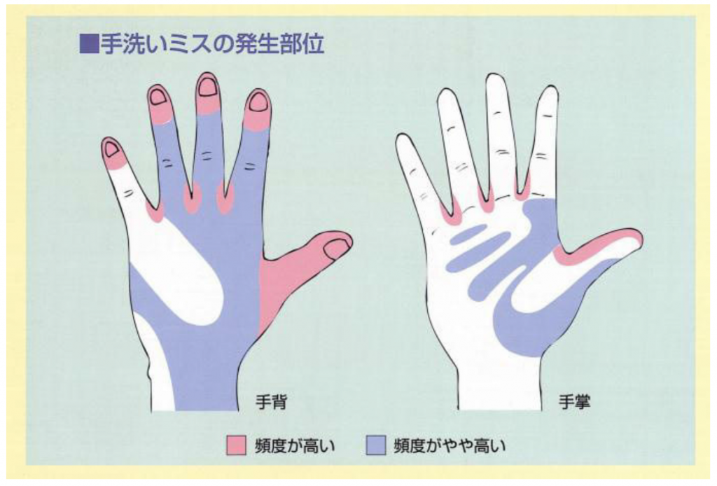 手洗いミスの部位